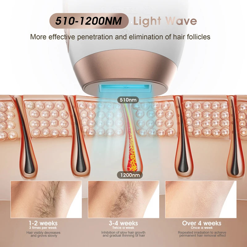 Appareil d'épilation à lumière pulsée (IPL) en vente directe d'usine 999999 Épilateur laser IPL pour une utilisation à domicile