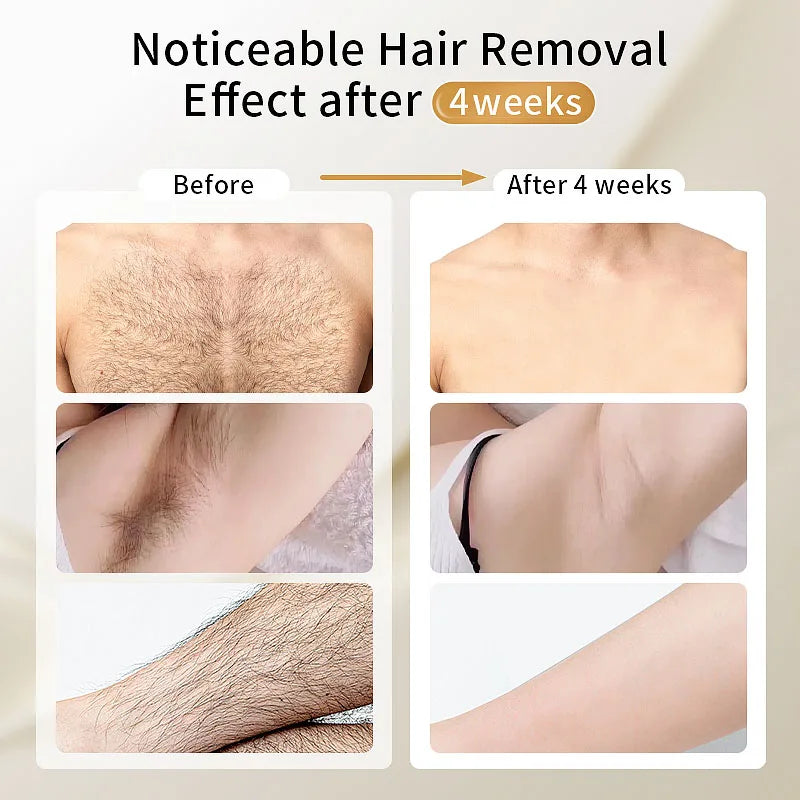 Épilateur laser Moolweel T001i Sapphire Cooling pour homme, à usage domestique, avec diode et lumière pulsée (IPL) pour le rajeunissement de la peau.