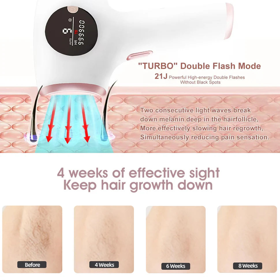 Épilateur IPL TZWM K-802, 999 999 flashs, 9 niveaux, refroidissement glace, 48 W, visage/corps