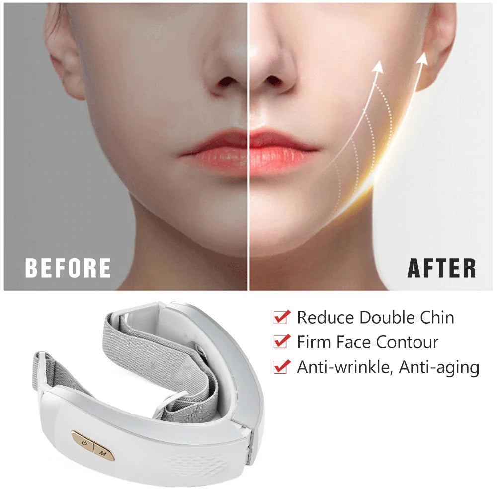 Appareil de Beauté KMD EMS | LED Rouge & Bleue, Thérapie Galvanique, Lifting et Raffermissement du Visage