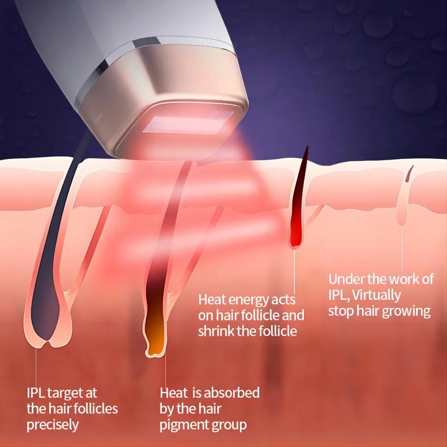 Épilateur laser/IPL Vancostar, 999 900 flashs, épilation/rajeunissement/acné 3 en 1, refroidissement, CE/FCC