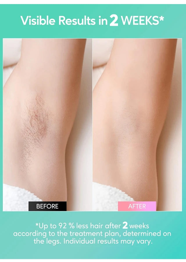 Épilateur laser IPL 999999 flashs pour femmes, usage domestique, épilation indolore, épilateur électrique pour maillot, livraison directe