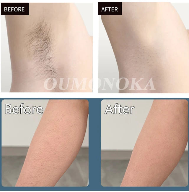 Épilateur laser IPL 999999 flashs pour femmes, usage domestique, épilation indolore, épilateur électrique pour maillot, livraison directe
