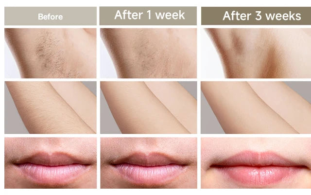 Épilateur laser IPL 999999 flashs pour femmes, usage domestique, épilation indolore, épilateur électrique pour maillot, livraison directe